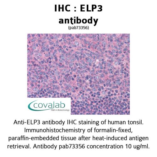 ELP3 antibody