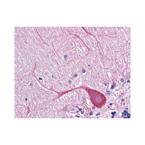 TLR3 antibody