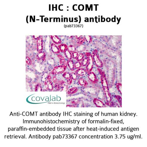 COMT (N-Terminus) antibody