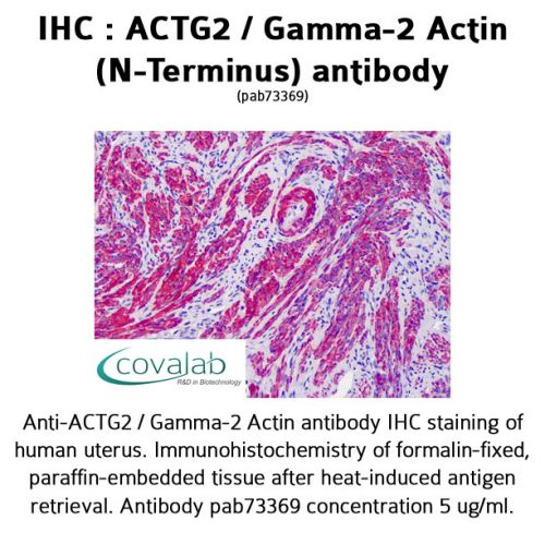 ACTG2 / Gamma-2 Actin (N-Terminus) antibody