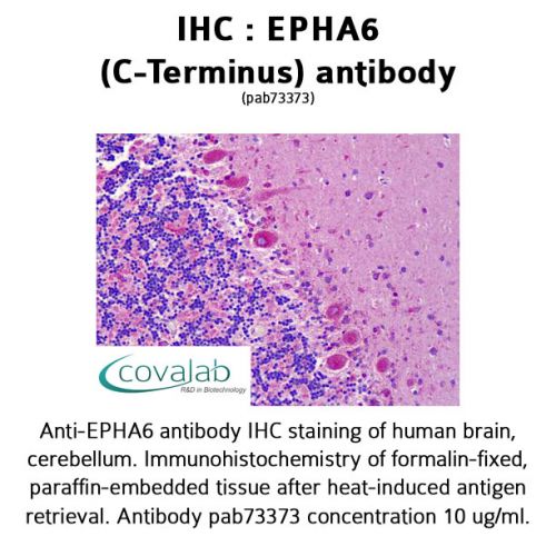 EPHA6 (C-Terminus) antibody
