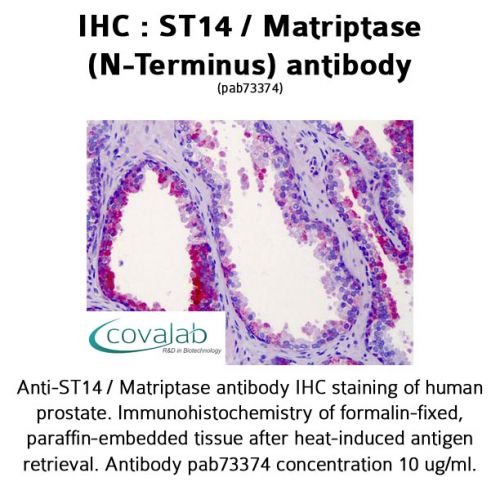 ST14 / Matriptase (N-Terminus) antibody