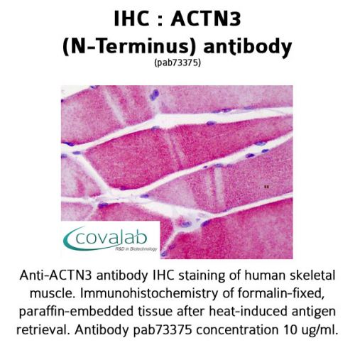 ACTN3 (N-Terminus) antibody