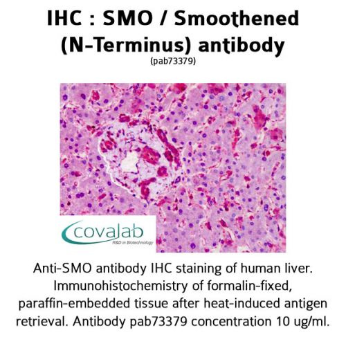 IHC : SMO / Smoothened (N-Terminus) antibody<br/>(pab73379)<br/>Anti-SMO antibody IHC of human liver. Immunohistochemistry of formalin-fixed, paraffin-embedded tissue after heat-induced antigen retrieval. Antibody concentration 10 µg/ml.