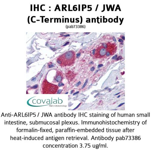 ARL6IP5 / JWA (C-Terminus) antibody