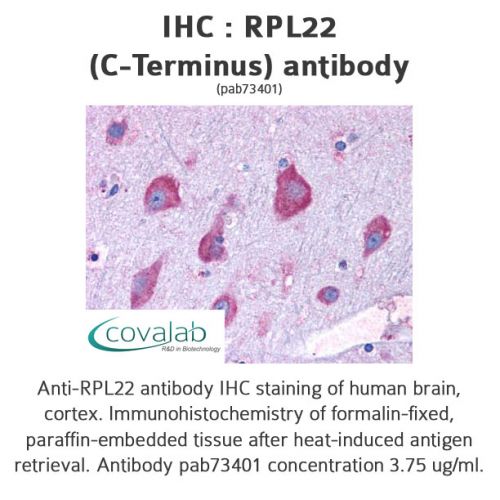 RPL22 (C-Terminus) antibody