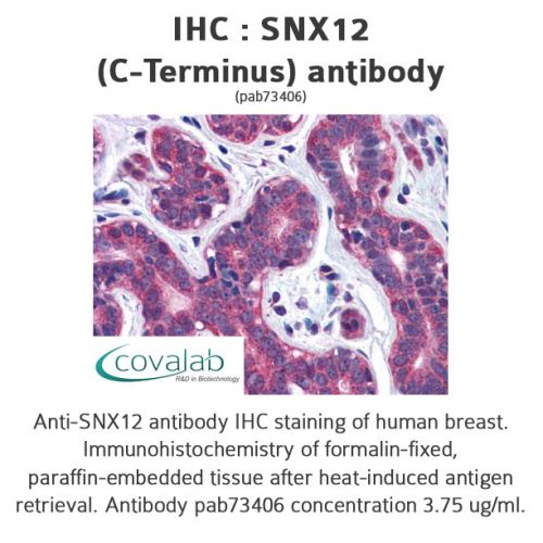 SNX12 (C-Terminus) antibody