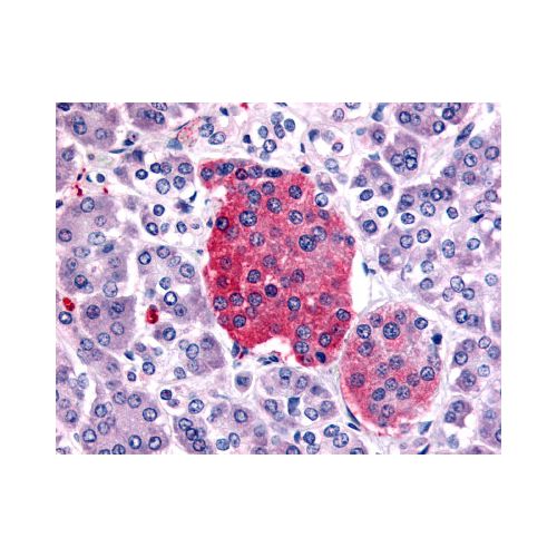 SSTR2 (C-Terminus) antibody