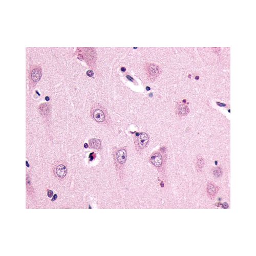 SSTR3 (C-Terminus) antibody