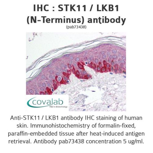 STK11 / LKB1 (N-Terminus) antibody