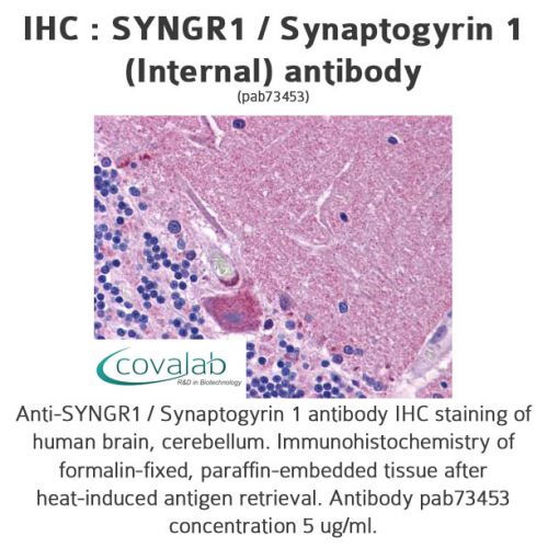 SYNGR1 / Synaptogyrin 1 (Internal) antibody