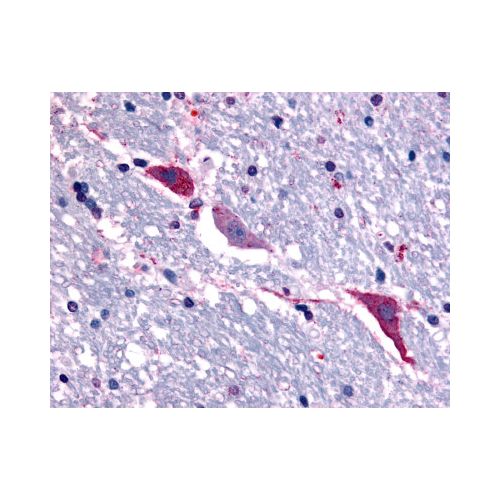 TACR3 (C-Terminus) antibody