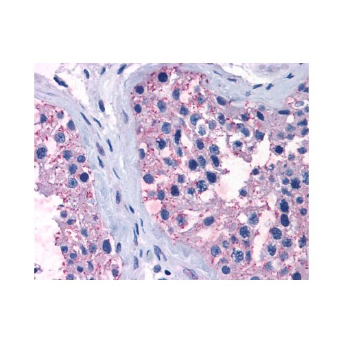 TAS1R1 (Cytoplasmic Domain) antibody