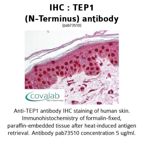 TEP1 (N-Terminus) antibody