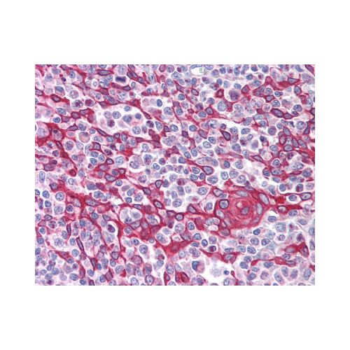 TIMD4 / TIM4 (Internal) antibody