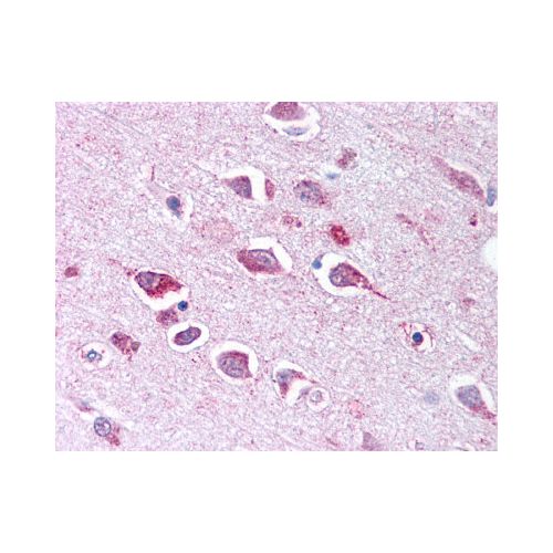 TLL2 (CUB 2 Domain) antibody