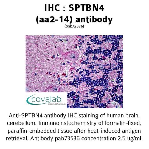 SPTBN4 (aa2-14) antibody