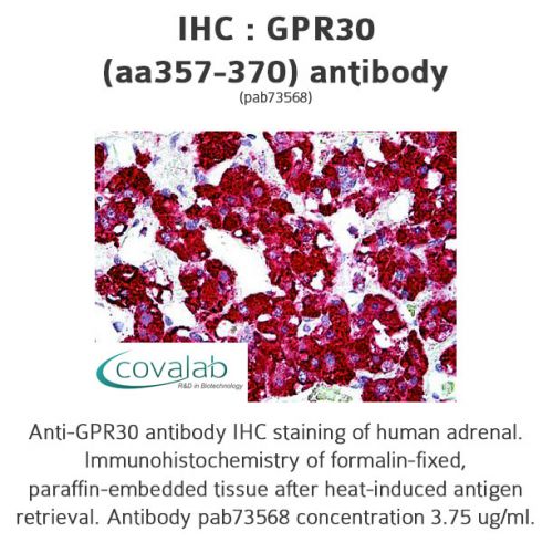 GPR30 (aa357-370) antibody