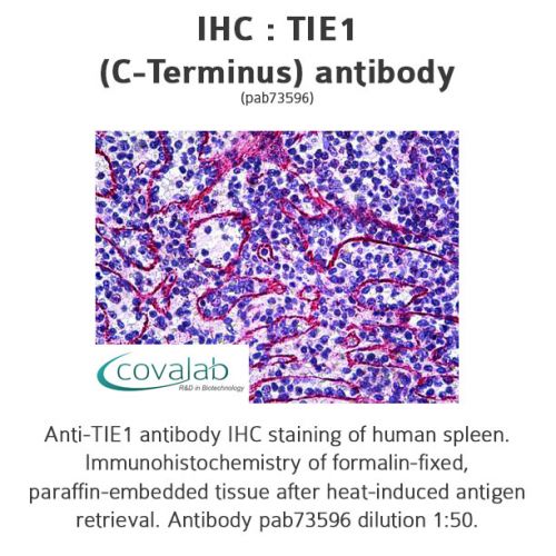 TIE1 (C-Terminus) antibody