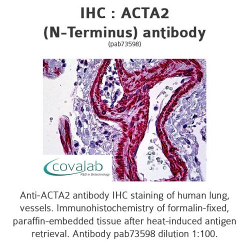 ACTA2 (N-Terminus) antibody