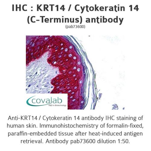 KRT14 / Cytokeratin 14 (C-Terminus) antibody