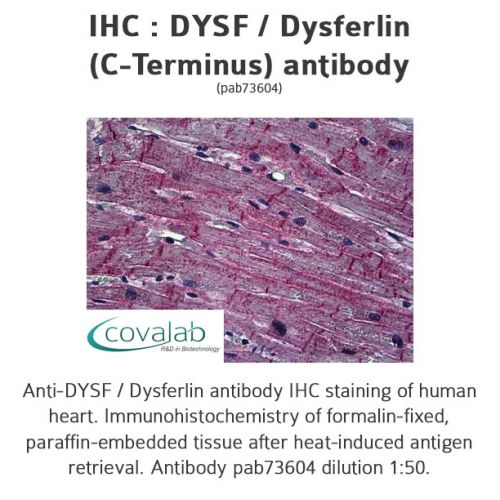 DYSF / Dysferlin (C-Terminus) antibody