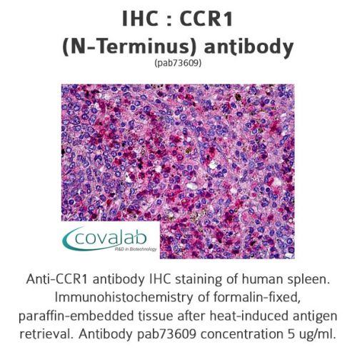 CCR1 (N-Terminus) antibody