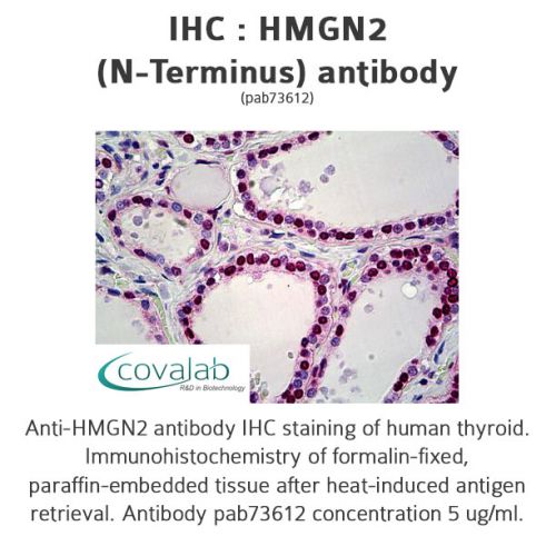 HMGN2 (N-Terminus) antibody