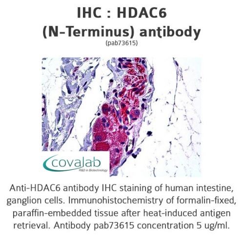 HDAC6 (N-Terminus) antibody