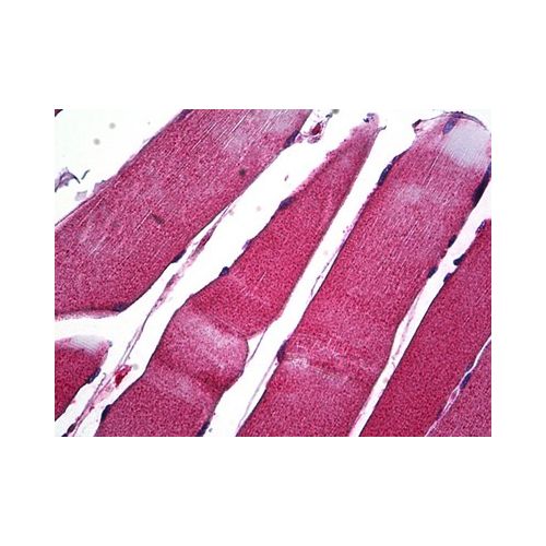 MMP1 (C-Terminus) antibody