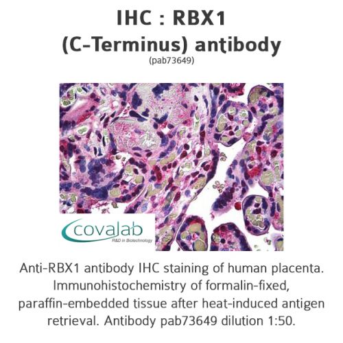 RBX1 (C-Terminus) antibody