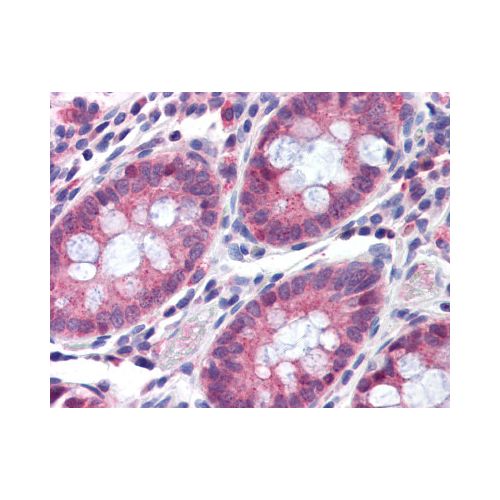 TMPRSS4 (Internal) antibody