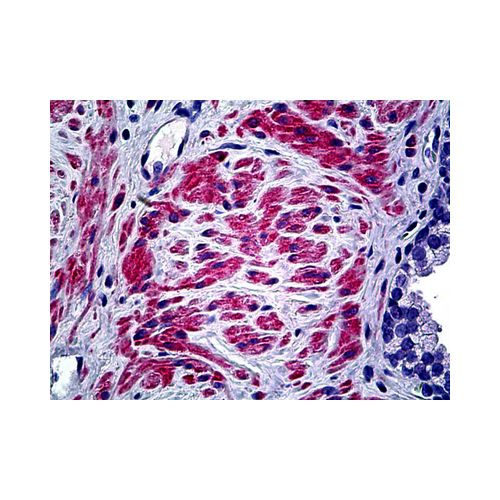 COL5A2 (N-Terminus) antibody