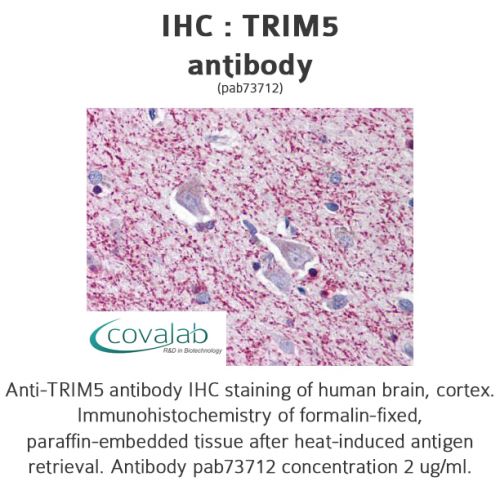 TRIM5 antibody
