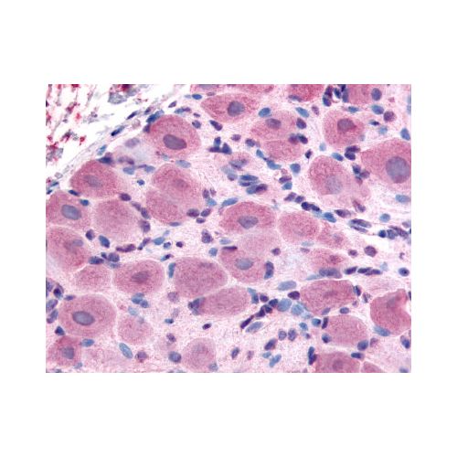 TRPA1 (Internal) antibody