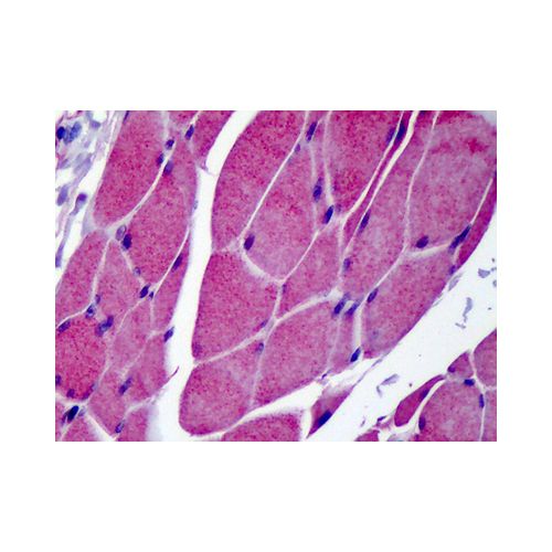 TRPC3 (C-Terminus) antibody