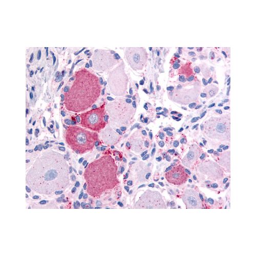 TRPV2 (N-Terminus) antibody