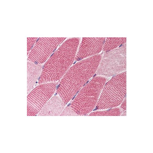 TSC1 antibody