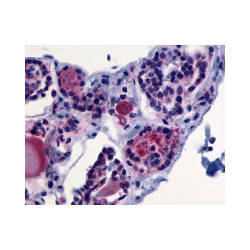 TSH Receptor (C-Terminus) antibody