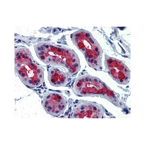 TSH Receptor (C-Terminus) antibody