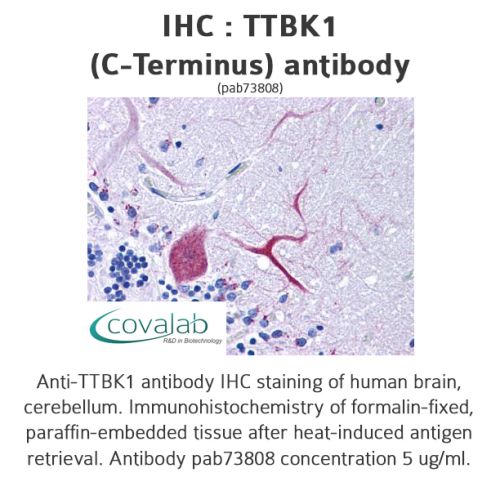 TTBK1 (C-Terminus) antibody