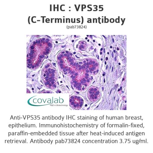 VPS35 (C-Terminus) antibody