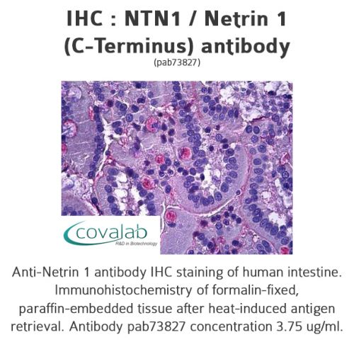 NTN1 / Netrin 1 (C-Terminus) antibody