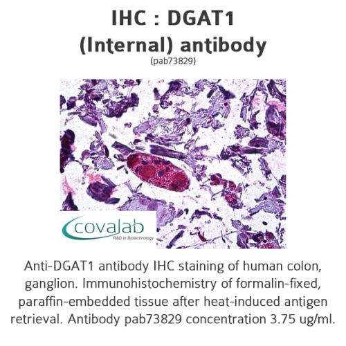 DGAT1 (Internal) antibody