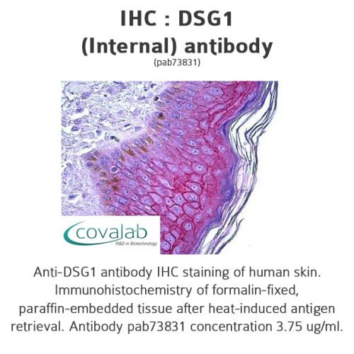 DSG1 (Internal) antibody