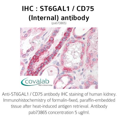 ST6GAL1 / CD75 (Internal) antibody