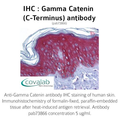 Gamma Catenin (C-Terminus) antibody