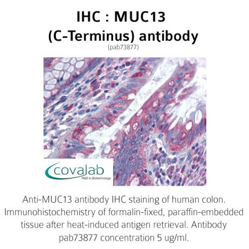 MUC13 (C-Terminus) antibody