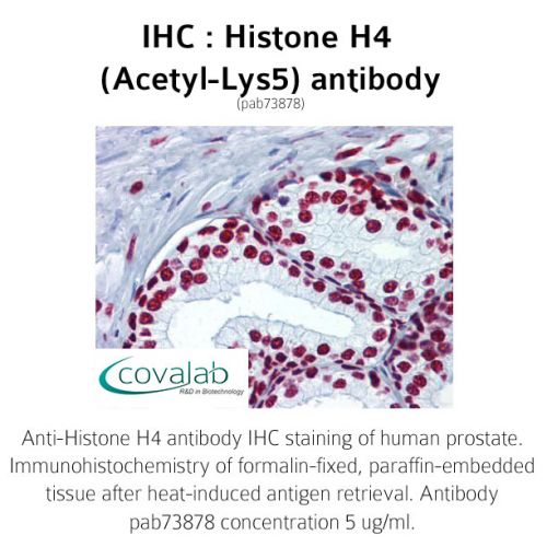 Histone H4 (Acetyl-Lys5) antibody