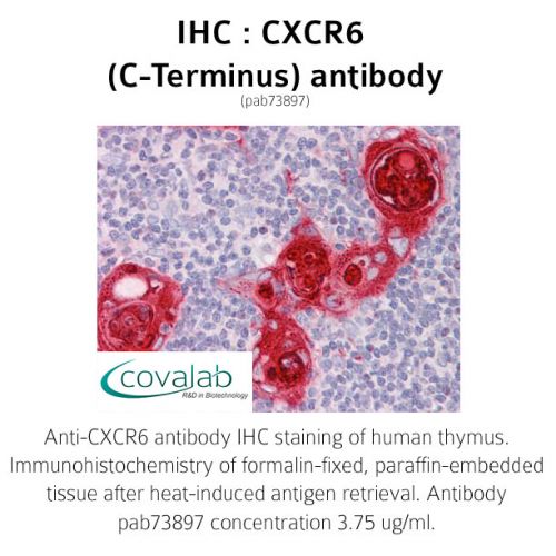 CXCR6 (C-Terminus) antibody